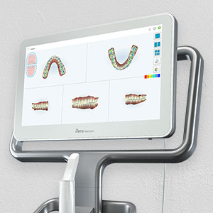 3d dental image display